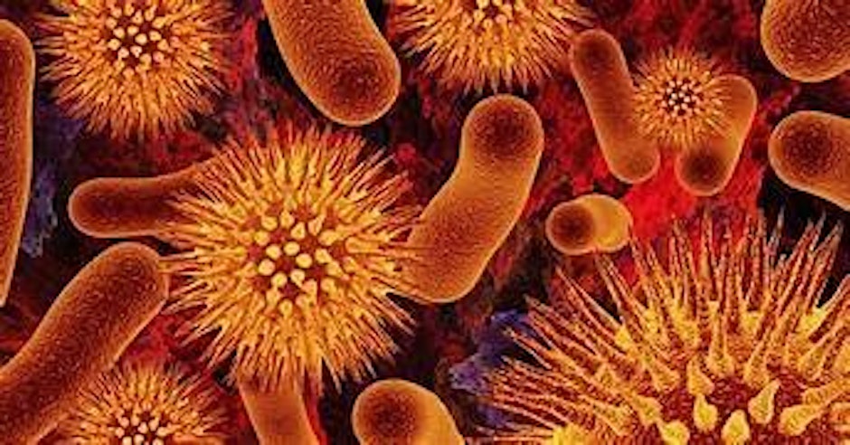Wales Regional Meeting - Food Microbiology Workshop - Root Cause Analysis (RCA)